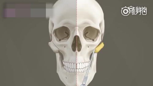 金希澈与Momo恋情曝光，同款高颧骨脸如何拯救？摸骨养生法大揭秘